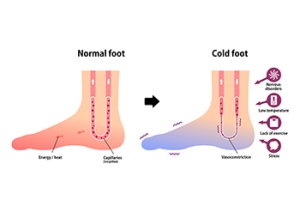 cold feet semaglutide Cold Feet May Be a Sign of Raynaud's Syndrome